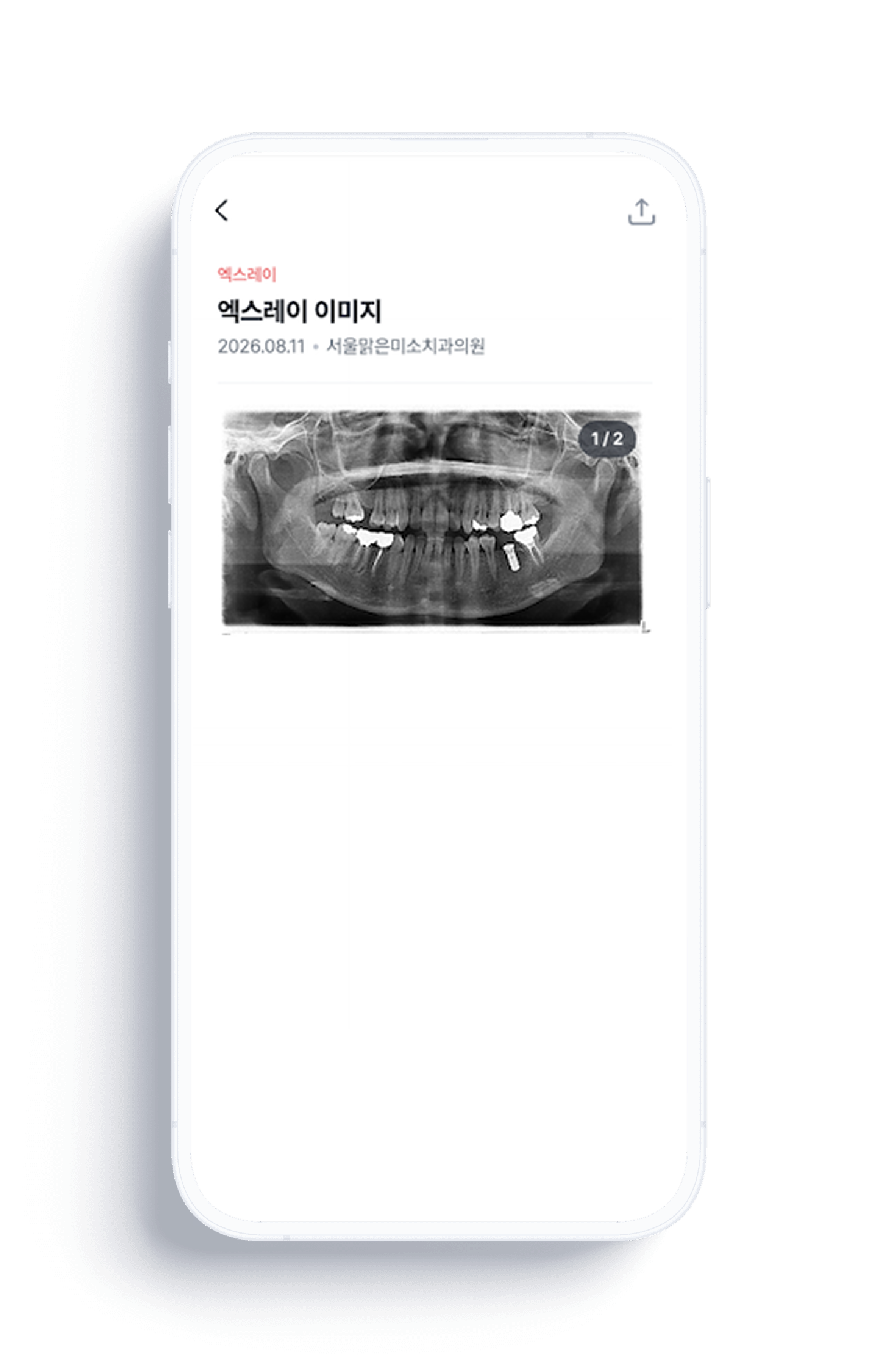 홈덴 앱에서 병원이 전달한 엑스레이 이미지를 확인하는 iOS 화면