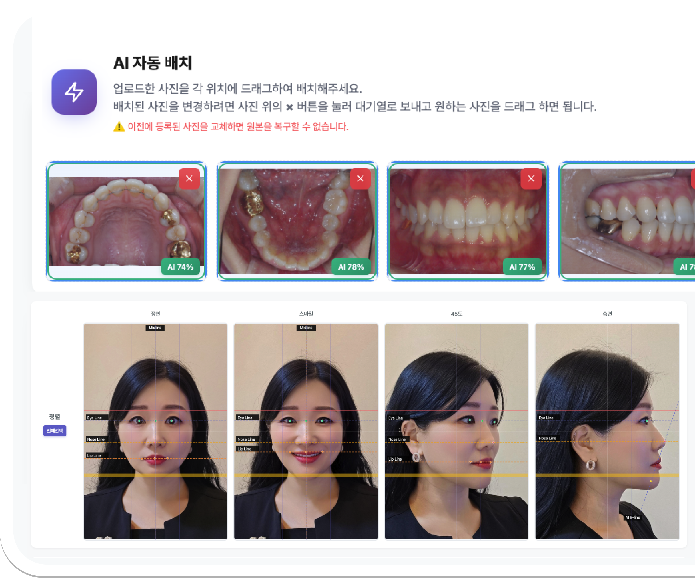 교정 일기 & 리포트