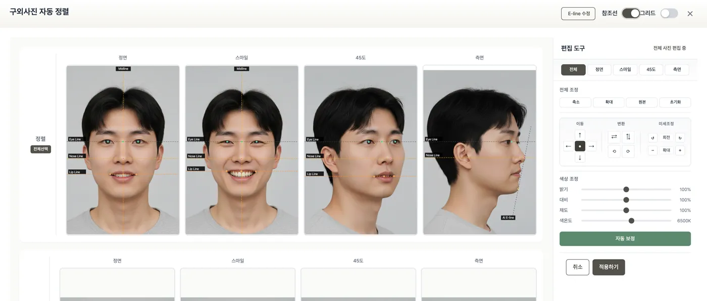 구외사진 자동 정렬 화면 예시. 정면·스마일·45도·측면 얼굴 사진이 같은 기준선에 맞춰 나란히 정렬됨