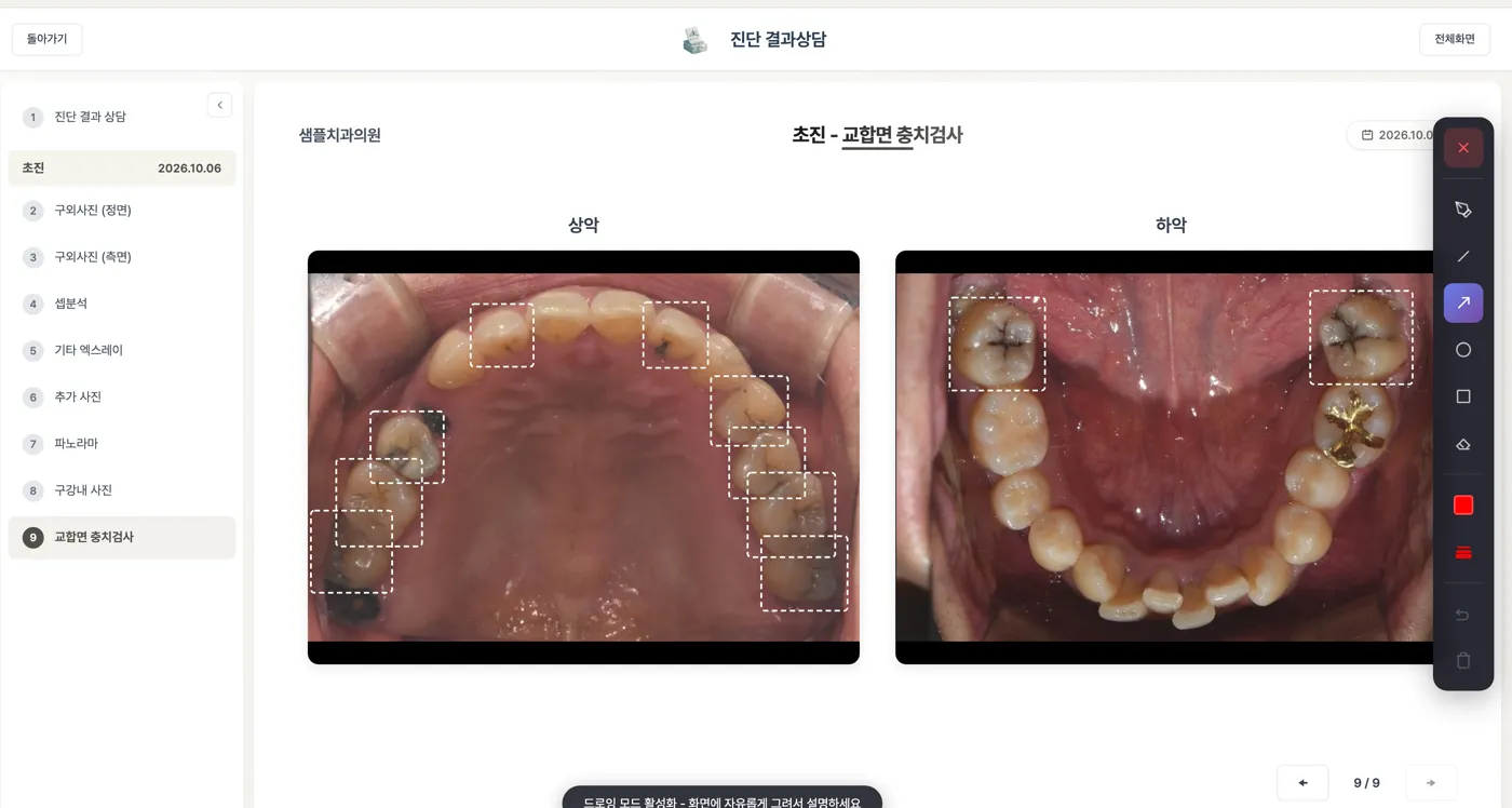 진단 결과 상담 슬라이드 예시. 초진 교합면 사진의 상악·하악에 살펴볼 치아가 점선 상자로 표시되고 왼쪽에 슬라이드 목록