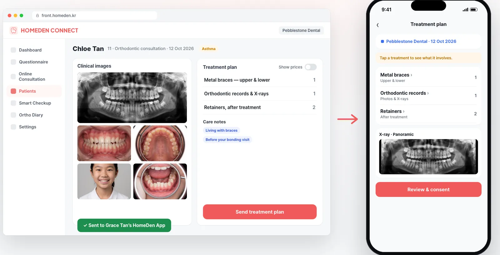 Example: in HomeDen Connect, a patient's clinical images and treatment plan are sent with one button, and the same plan and panoramic X-ray appear in the patient's HomeDen App, ready to review and consent