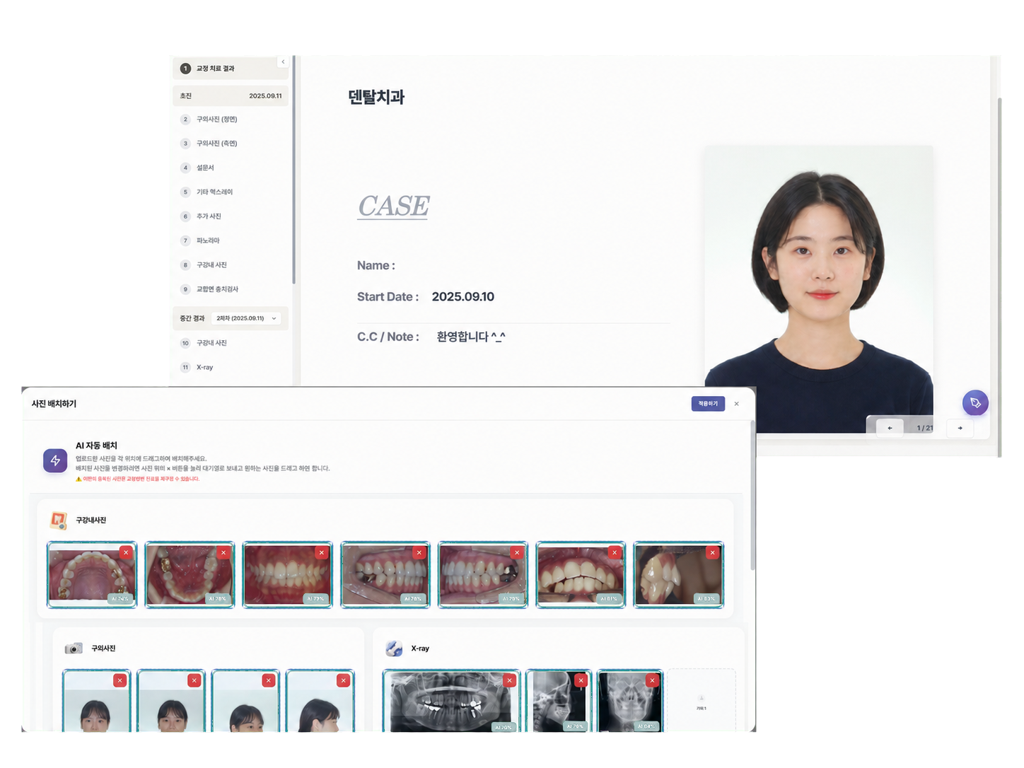 구강 사진과 X-ray를 자동 배치하고 진료 자료를 정리하는 화면